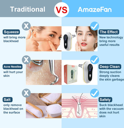 Electric Blackhead Remover Kit